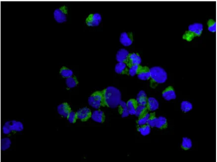 Immunocytochemistry/ Immunofluorescence - Anti-D4 GDI antibody [EPR14212(B)] (AB181252)