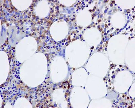 Immunohistochemistry (Formalin/PFA-fixed paraffin-embedded sections) - Anti-D4 GDI antibody [EPR14212(B)] (AB181252)