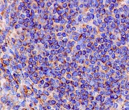 Immunohistochemistry (Formalin/PFA-fixed paraffin-embedded sections) - Anti-D4 GDI antibody [EPR14212(B)] (AB181252)