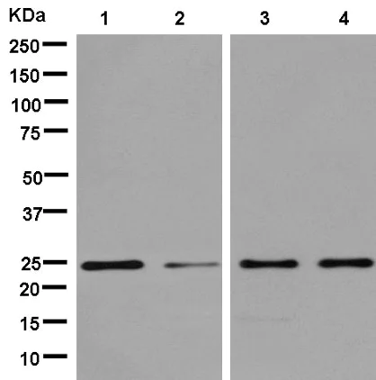 Western blot - Anti-D4 GDI antibody [EPR14212(B)] (AB181252)