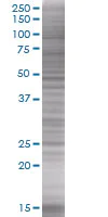SDS-PAGE - D4 GDI overexpression 293T lysate (whole cell) (AB94194)