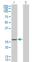 Western blot - D4 GDI overexpression 293T lysate (whole cell) (AB94194), expandable thumbnail