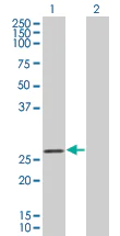 Western blot - D4 GDI overexpression 293T lysate (whole cell) (AB94194)