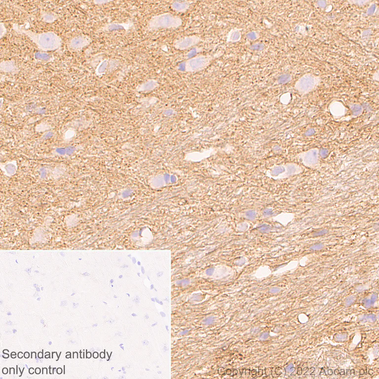 Immunohistochemistry - Anti-DAAM1 antibody [EPR25376-223] (AB307160)