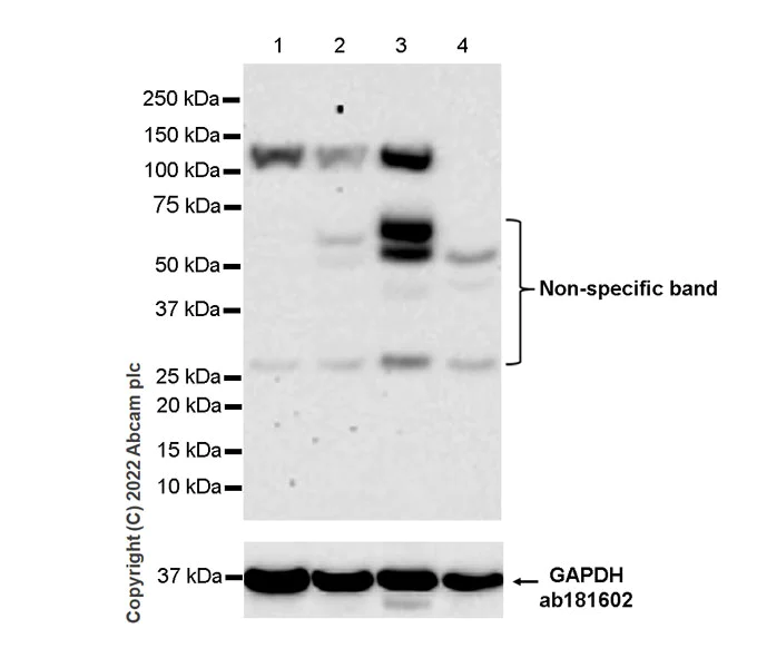 Western blot - Anti-DAAM1 antibody [EPR25376-223] (AB307160)