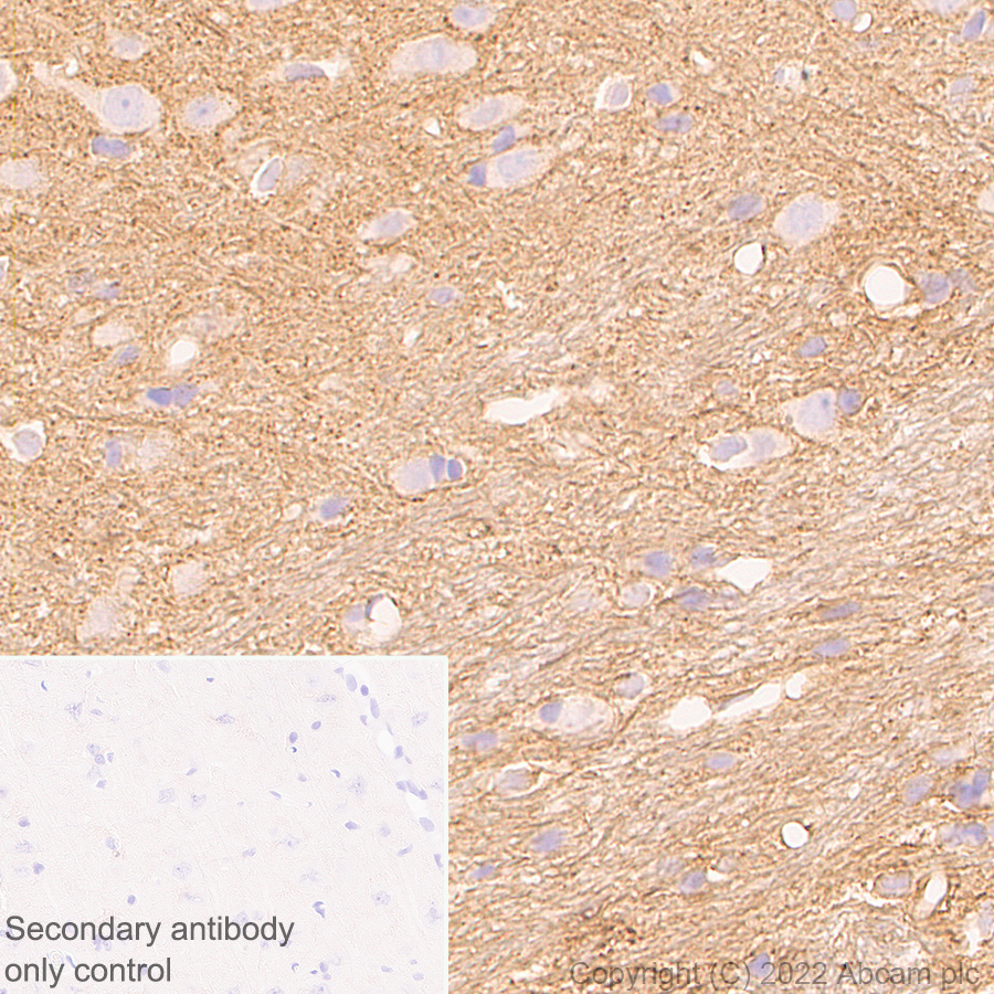 Immunohistochemistry - Anti-DAAM1 antibody [EPR25376-223] - BSA and Azide free (AB307161), expandable thumbnail