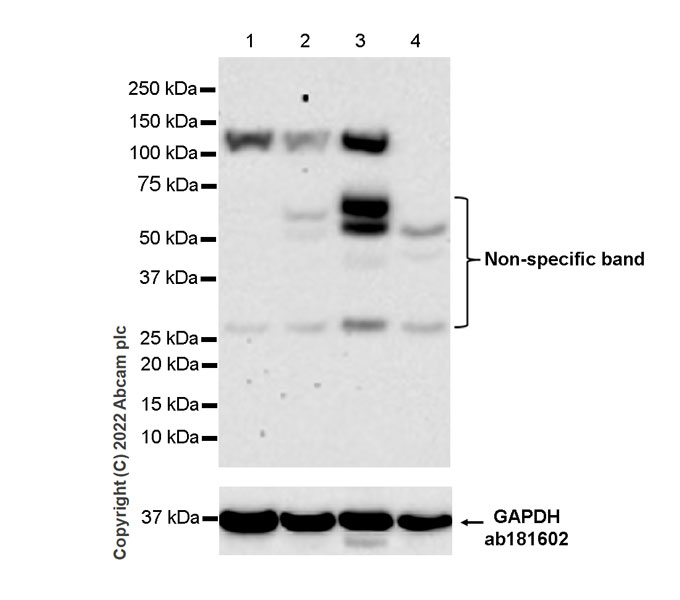 Western blot - Anti-DAAM1 antibody [EPR25376-223] - BSA and Azide free (AB307161), expandable thumbnail