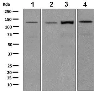 Western blot - Anti-DAAM2 antibody [EPR10797(B] (AB169527)