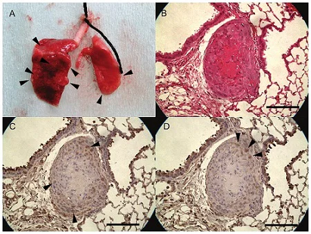 Immunohistochemistry (Formalin/PFA-fixed paraffin-embedded sections) - DAB Substrate Kit (AB64238)