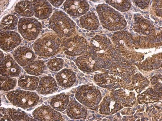Immunohistochemistry (Formalin/PFA-fixed paraffin-embedded sections) - Anti-Dab1 antibody (AB111684)