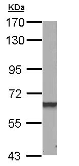 Western blot - Anti-Dab1 antibody (AB111684)