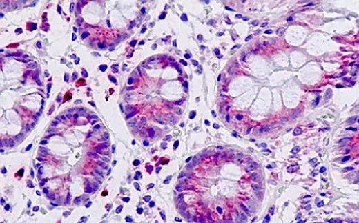 Immunohistochemistry (Formalin/PFA-fixed paraffin-embedded sections) - Anti-Dab1 antibody (AB189426)