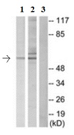 Western blot - Anti-Dab1 antibody (AB189426), expandable thumbnail
