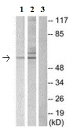 Western blot - Anti-Dab1 antibody (AB189426)