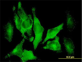 Immunocytochemistry/ Immunofluorescence - Anti-DAB2 antibody (AB88590)