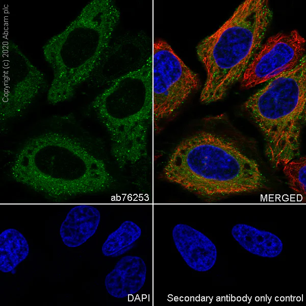 Immunocytochemistry/ Immunofluorescence - Anti-DAB2 antibody [EP2297Y] (AB76253)