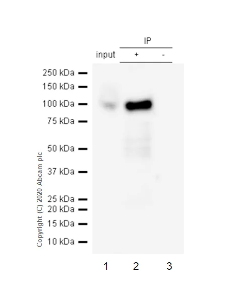 Immunoprecipitation - Anti-DAB2 antibody [EP2297Y] (AB76253)
