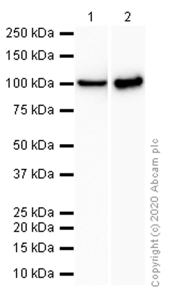 Western blot - Anti-DAB2 antibody [EP2297Y] (AB76253)