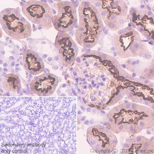 Immunohistochemistry (Formalin/PFA-fixed paraffin-embedded sections) - Anti-DAB2 antibody [EPR22881-69] (AB256524)