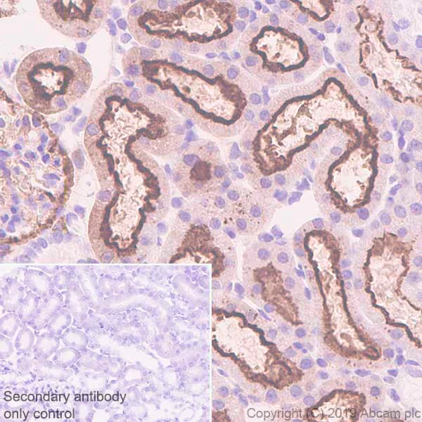 Immunohistochemistry (Formalin/PFA-fixed paraffin-embedded sections) - Anti-DAB2 antibody [EPR22881-69] (AB256524)
