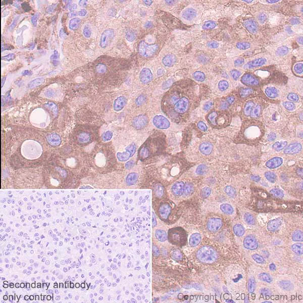Immunohistochemistry (Formalin/PFA-fixed paraffin-embedded sections) - Anti-DAB2 antibody [EPR22881-69] (AB256524)