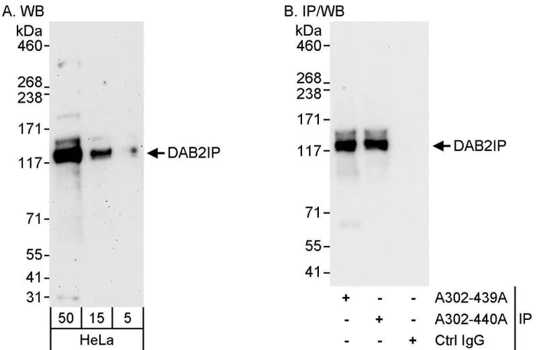 Immunoprecipitation - Anti-DAB2IP antibody (AB87811)