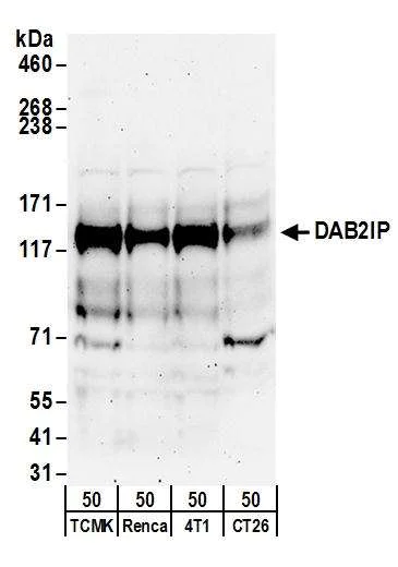 Western blot - Anti-DAB2IP antibody (AB87811)