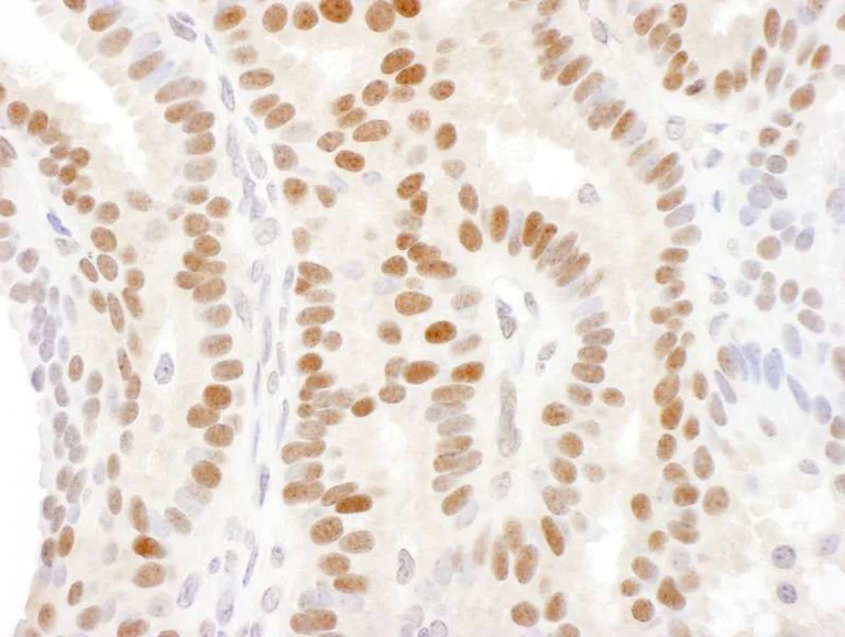 Immunohistochemistry (Formalin/PFA-fixed paraffin-embedded sections) - Anti-DACH1 antibody (AB176718)