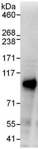 Immunoprecipitation - Anti-DACH1 antibody (AB176718)