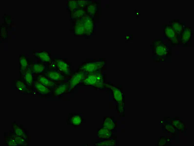 Immunocytochemistry/ Immunofluorescence - Anti-DACH1 antibody (AB222832)