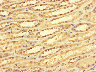 Immunohistochemistry (Formalin/PFA-fixed paraffin-embedded sections) - Anti-DACH1 antibody (AB222832)