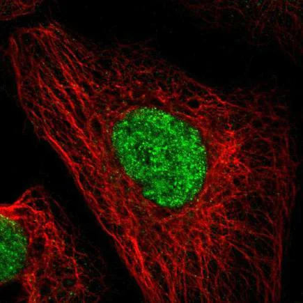 Immunocytochemistry/ Immunofluorescence - Anti-DACH1 antibody (AB223703)