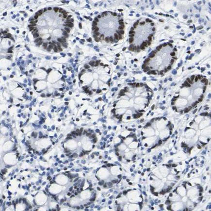 Immunohistochemistry (Formalin/PFA-fixed paraffin-embedded sections) - Anti-DACH1 antibody (AB223703)