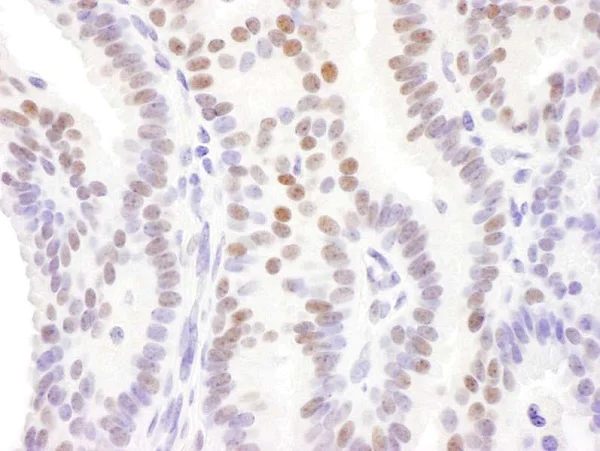 Immunohistochemistry (Formalin/PFA-fixed paraffin-embedded sections) - Anti-DACH1 antibody (AB226176)