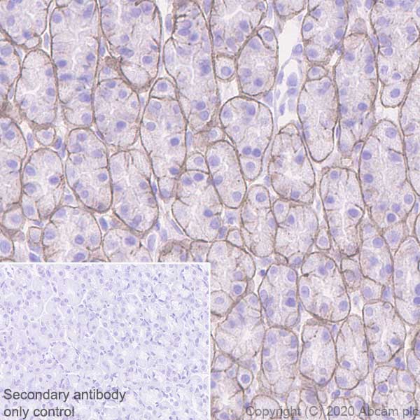 Immunohistochemistry (Formalin/PFA-fixed paraffin-embedded sections) - Anti-DAG1 antibody [IIH6C4] (AB234587)
