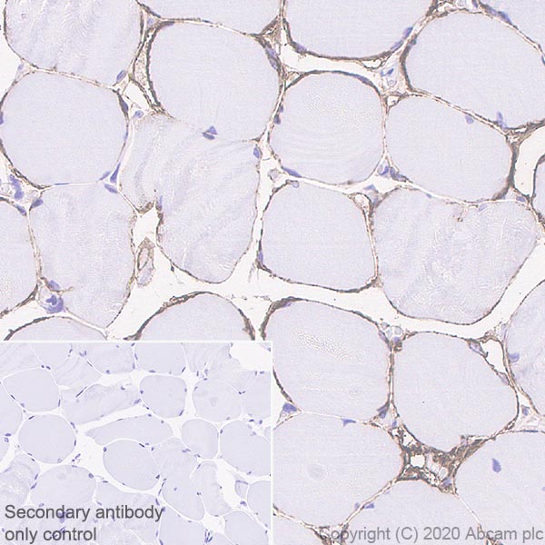 Immunohistochemistry (Formalin/PFA-fixed paraffin-embedded sections) - Anti-DAG1 antibody [IIH6C4] (AB234587)