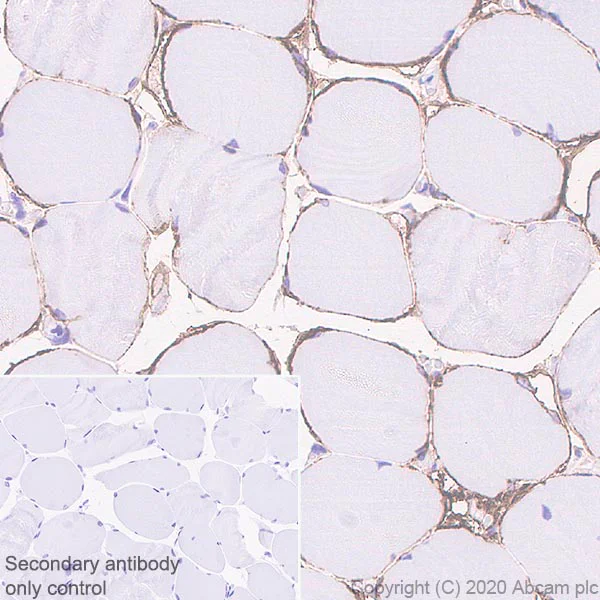 Immunohistochemistry (Formalin/PFA-fixed paraffin-embedded sections) - Anti-DAG1 antibody [IIH6C4] (AB234587)