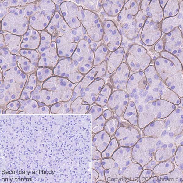Immunohistochemistry (Formalin/PFA-fixed paraffin-embedded sections) - Anti-DAG1 antibody [IIH6C4] (AB234587)
