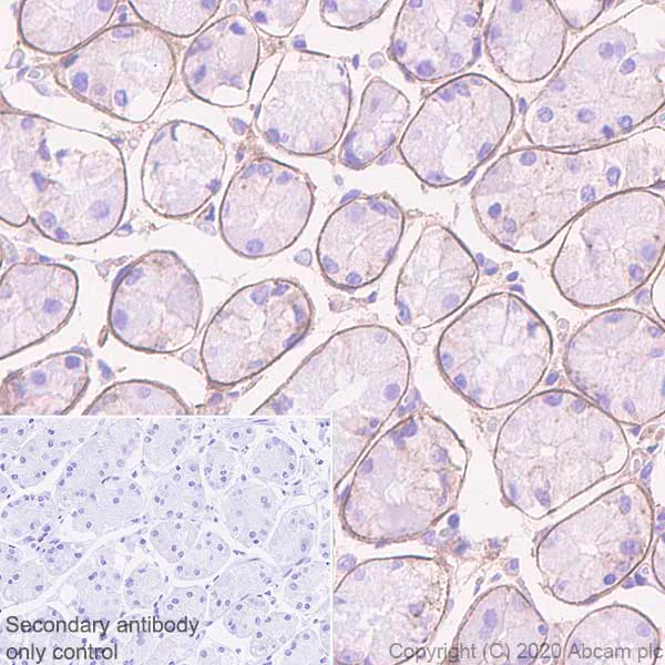 Immunohistochemistry (Formalin/PFA-fixed paraffin-embedded sections) - Anti-DAG1 antibody [IIH6C4] (AB234587)