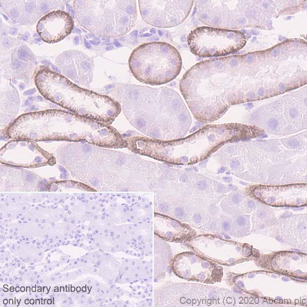 Immunohistochemistry (Formalin/PFA-fixed paraffin-embedded sections) - Anti-DAG1 antibody [IIH6C4] (AB234587)