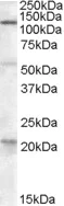 Western blot - Anti-DAGLA antibody (AB81984)