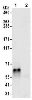 Immunoprecipitation - Anti-DAGLB antibody - C-terminal (AB191159)