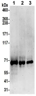 Western blot - Anti-DAGLB antibody - C-terminal (AB191159)