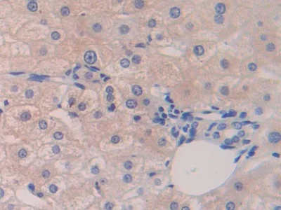 Immunohistochemistry (Formalin/PFA-fixed paraffin-embedded sections) - Anti-DAI antibody (AB232977)