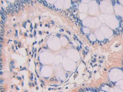 Immunohistochemistry (Formalin/PFA-fixed paraffin-embedded sections) - Anti-DAI antibody (AB232977)