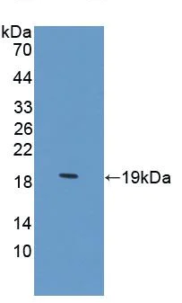 Western blot - Anti-DAI antibody (AB232977)