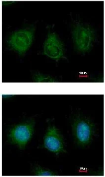 Immunocytochemistry/ Immunofluorescence - Anti-DAK antibody (AB137623)