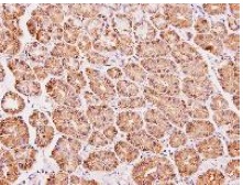 Immunohistochemistry (Formalin/PFA-fixed paraffin-embedded sections) - Anti-DAK antibody (AB137623), expandable thumbnail