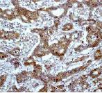 Immunohistochemistry (Formalin/PFA-fixed paraffin-embedded sections) - Anti-DAP1 antibody [E59] (AB32056)