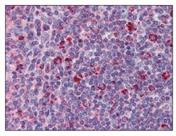 Immunohistochemistry (Formalin/PFA-fixed paraffin-embedded sections) - Anti-DAP12 antibody (AB110117), expandable thumbnail